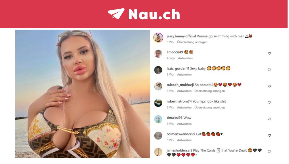 Influencerin Jessy Bunny schockt mit XXXL-Lippen (Nau.ch)